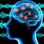 brain electrical image (1)